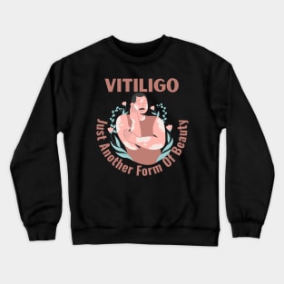 Vitiligo Just Another Form Of Beauty Male Model Crewneck Sweatshirt